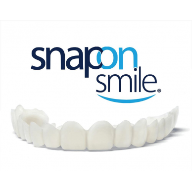 Snap-On Smile - съемные виниры для красивой улыбки